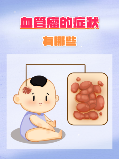 血管瘤和鲜红斑痣区别在哪？